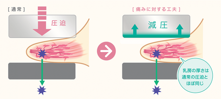 痛みにたいする工夫